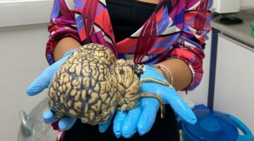 cérebro sendo segurado pelas mãos de uma pesquisadora.