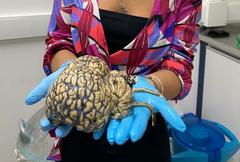 cérebro sendo segurado pelas mãos de uma pesquisadora.